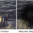 macular degeneration: Symptoms and Causes of Macular Degeneration