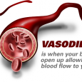 Vasoconstriction: Causes, Symptoms & Treatment