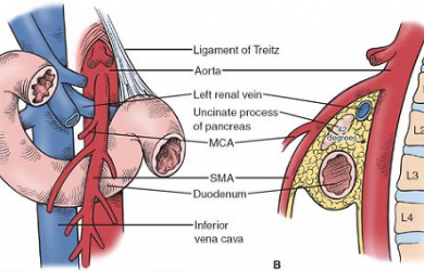 What is the ligament of treitz? (write history and etymology as well) Origin of the ligament of treitz Structure of the ligament of treitz Anatomic variations of the ligament of treitz Functions of the ligament of treitz Clinical and pathological importance of the ligament of treitz Intestinal malrotation and ligament of treitz SMAS and the ligament of treitz Conclusion