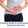 Explosive Diarrhea Symptoms, Causes, Home Remedies, Treatment, Diagnosis