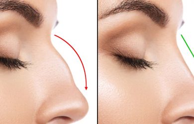 Benefits of Getting a Rhinoplasty and How to Choose the Right Service
