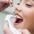 3 Things You Can Expect During a Pediatric Dental Cleaning Service