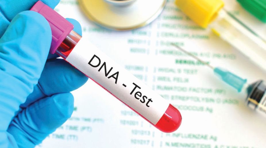 Best DNA Test Kits of 2020 - Unbiased Reviews [ Must Check ]
